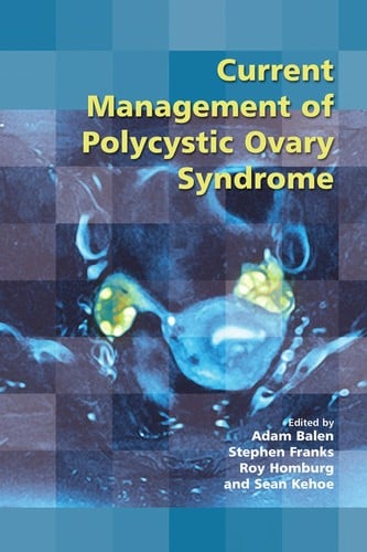 Current management of polycystic ovary syndrome