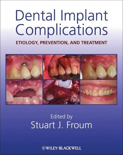 Dental implant complications