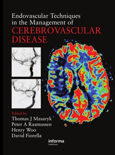 Endovascular techniques in the management of cerebrovascular disease
