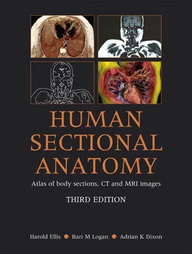 Human sectional anatomy