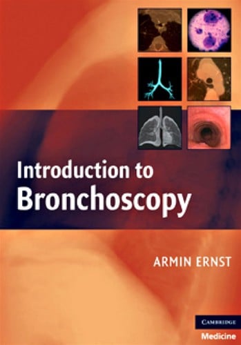 Introduction to bronchoscopy