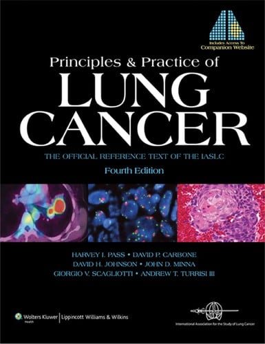 Principles and practice of lung cancer