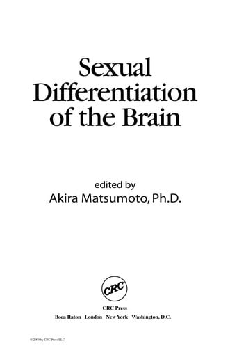 Sexual differentiation of the brain