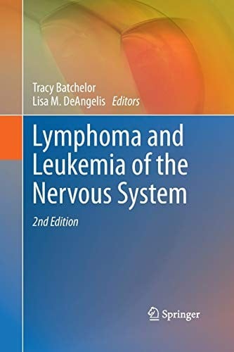 Lymphoma and leukemia of the nervous system