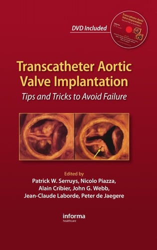 Transcatheter aortic valve transplantation