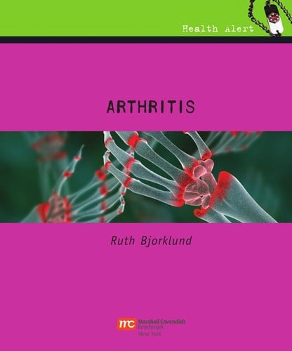 Arthritis