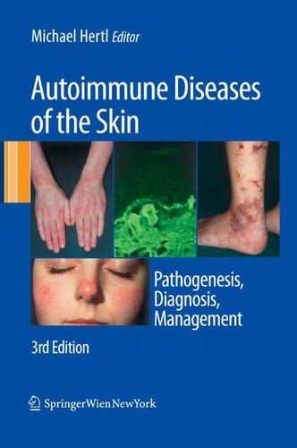 Autoimmune diseases of the skin