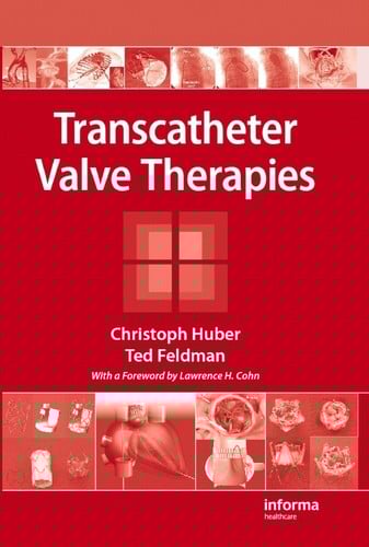 Transcatheter valve therapies
