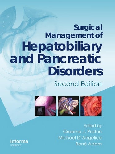 Surgical management of hepatobiliary and pancreatic disorders