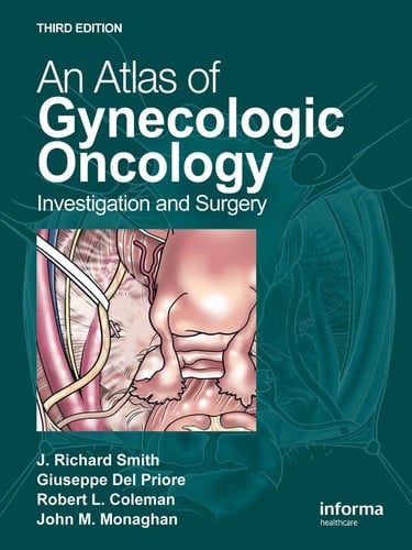 An atlas of gynecologic oncology