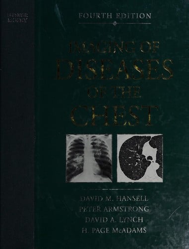 Imaging of the diseases of the chest