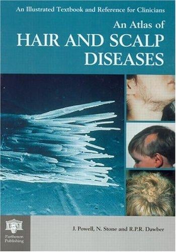 An Atlas of Hair and Scalp Diseases (The Encyclopedia of Visual Medicine Series)