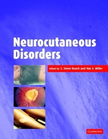 Neurocutaneous disorders