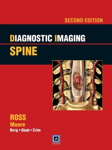 Diagnostic Imaging : Spine: Published by Amirsys®