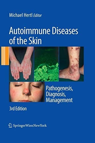 Autoimmune Diseases of the Skin: Pathogenesis, Diagnosis, Management
