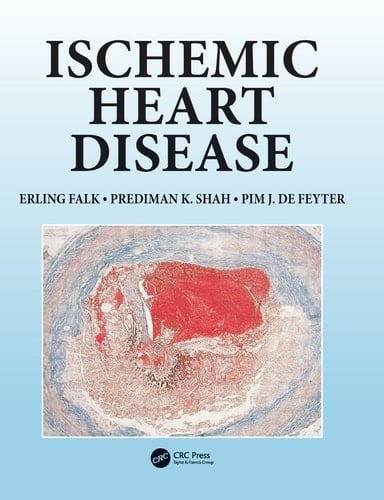 Ischemic Heart Disease