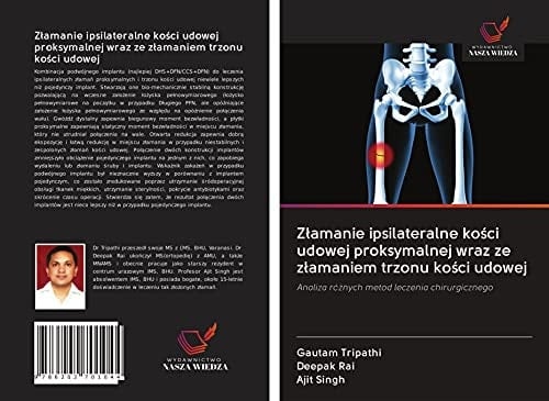 Złamanie ipsilateralne kości udowej proksymalnej wraz ze złamaniem trzonu kości udowej: Analiza różnych metod leczenia chirurgicznego (Polish Edition)