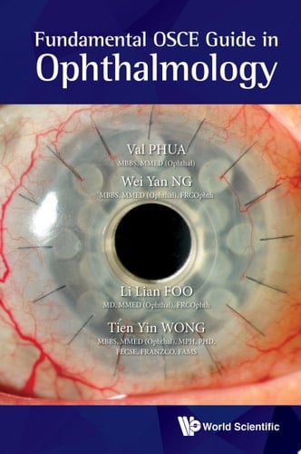 Fundamental OSCE Guide in Ophthalmology