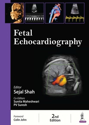 Fetal Echocardiography