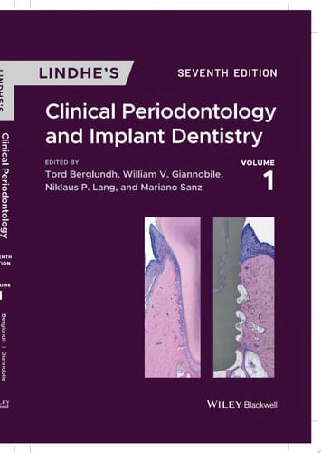 Lindhe's Clinical Periodontology and Implant Dentistry, 2 Volume Set