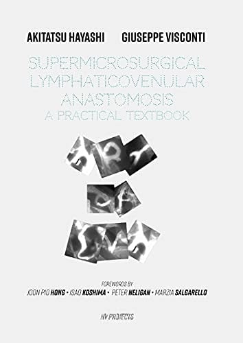 Supermicrosurgical LymphaticoVenular Anastomosis A Practical Textbook. : LVA Textbook