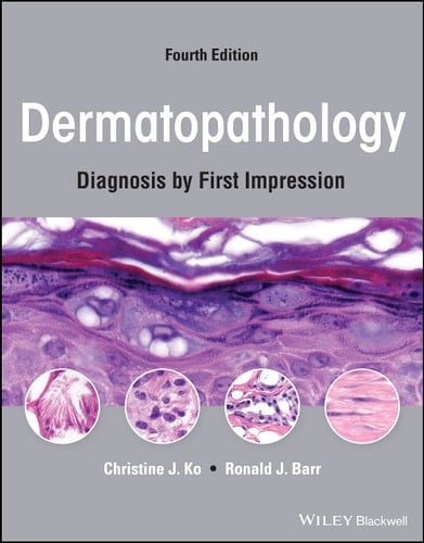 Dermatopathology Diagnosis by First Impression