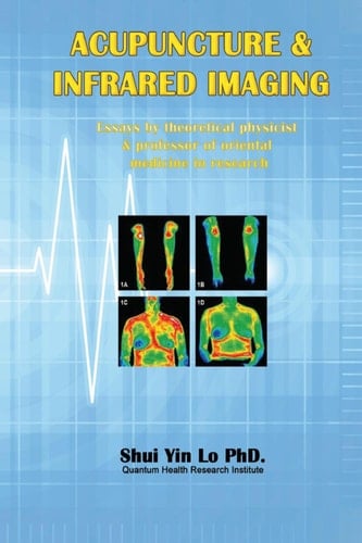 Acupuncture and Infrared Imaging: Essays by theoretical physicist & professor of oriental medicine in research