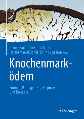 Knochenmarködem Formen, Pathogenese, Diagnose und Therapie
