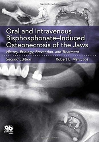 Oral and Intravenous Bisphosphonate-induced Osteonecrosis of the Jaws History, Etiology, Prevention, and Treatment