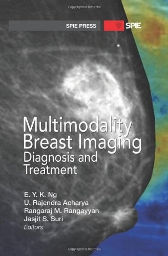 Multimodality Breast Imaging Diagnosis and Treatment
