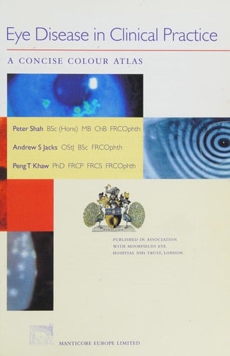 Eye Disease in Clinical Practice A Concise Colour Atlas