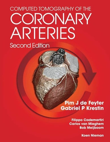Computed Tomography of the Coronary Arteries