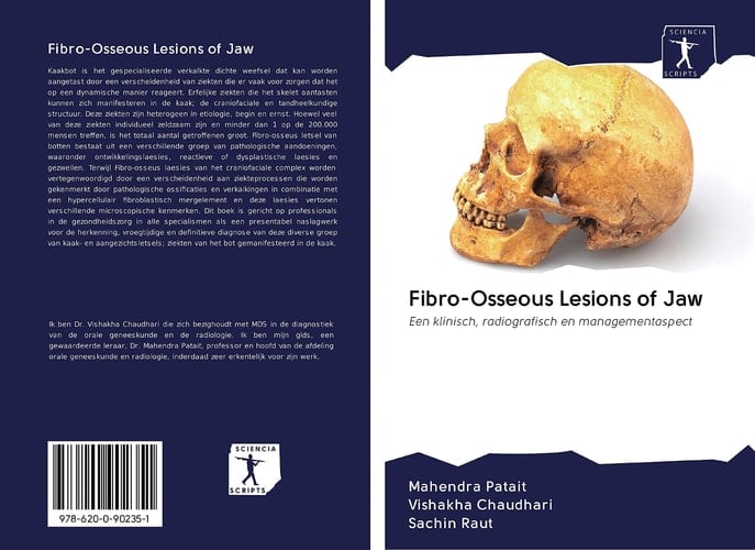Fibro-Osseous Lesions of Jaw: Een klinisch, radiografisch en managementaspect (Dutch Edition)