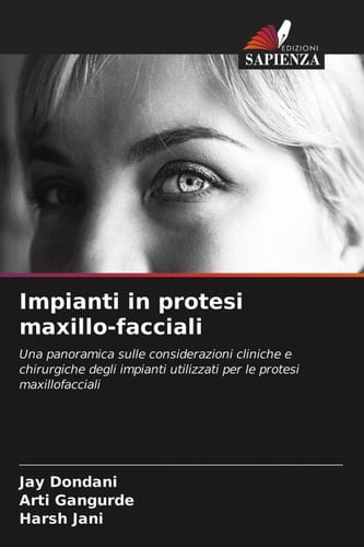 Impianti in protesi maxillo-facciali: Una panoramica sulle considerazioni cliniche e chirurgiche degli impianti utilizzati per le protesi maxillofacciali (Italian Edition)