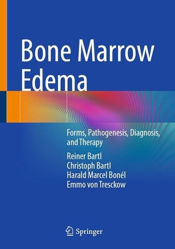 Bone Marrow Edema Forms, Pathogenesis, Diagnosis, and Therapy