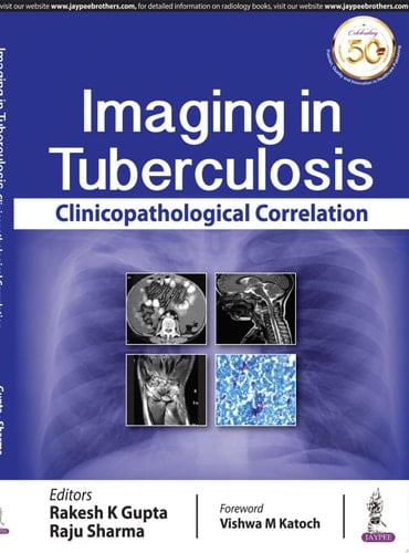 Imaging in Tuberculosis Clinicopathological Correlation