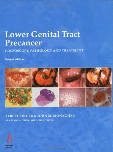Lower Genital Tract Precancer Colposcopy, Pathology and Treatment
