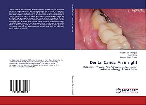 Dental Caries: An Insight Definations, Theories,Etio-Pathogenesis, Mechanism and Histopathology of Dental Caries