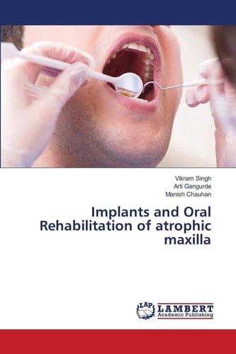 Implants and Oral Rehabilitation of Atrophic Maxilla