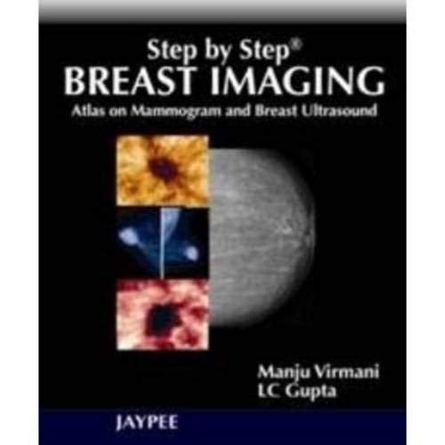 Step by Step: Breast Imaging
