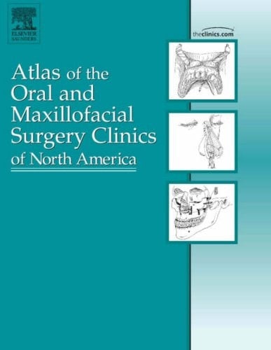 Mandibular Reconstruction An Issue of Atlas of the Oral and Maxillofacial Surgery Clinics