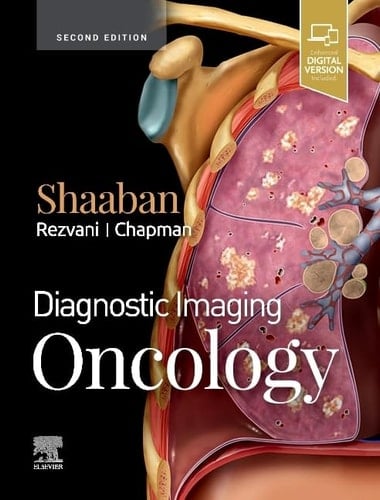 Oncology