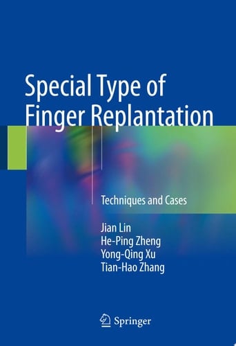 Special Type of Finger Replantation