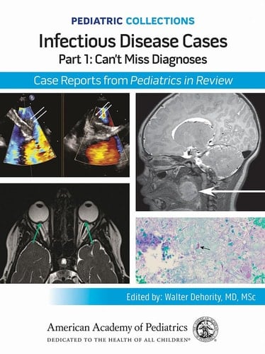 Can't Miss Diagnoses Case Reports from Pediatrics in Review