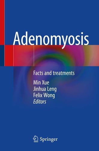 Adenomyosis Facts and treatments