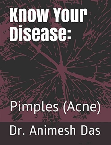 Know Your Disease: Pimples (Acne)