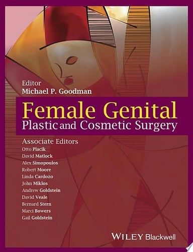 Female Genital Plastic and Cosmetic Surgery