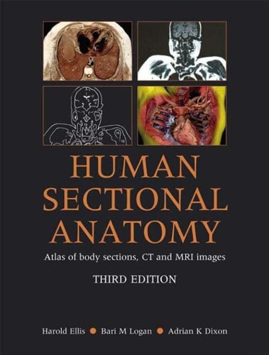 Human Sectional Anatomy Atlas of Body Sections, CT and MRI Images, Third Edition