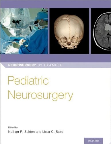Pediatric Neurosurgery (Neurosurgery by Example)