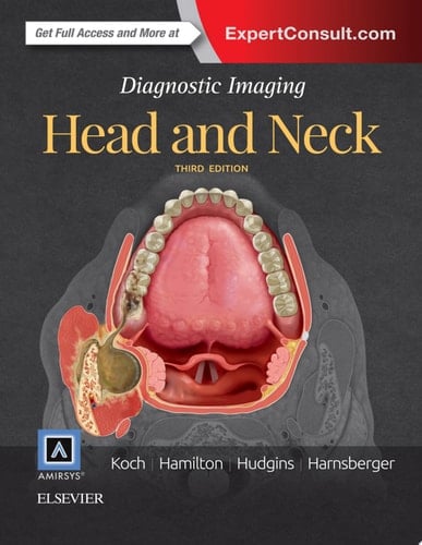 Diagnostic Imaging: Head and Neck E-Book Diagnostic Imaging: Head and Neck E-Book